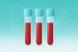 ناشتایی قبل از آزمایش خون چقدر است