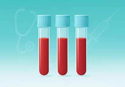 ناشتایی قبل از آزمایش خون چقدر است